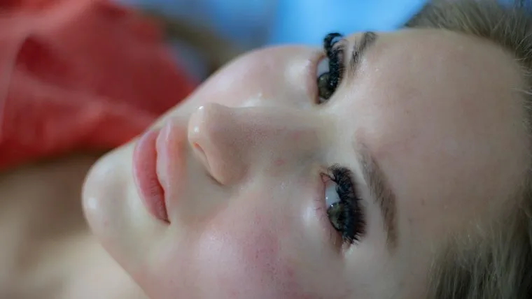 Votre peau sans acné : un traitement naturel pour la sauver