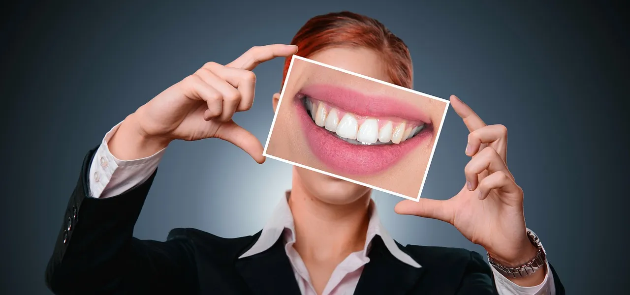 Comment avoir des dents blanches pour un sourire à la mode ?