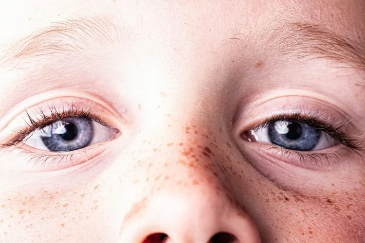 Pores dilatés sur le nez : comment m’en débarrasser naturellement ?