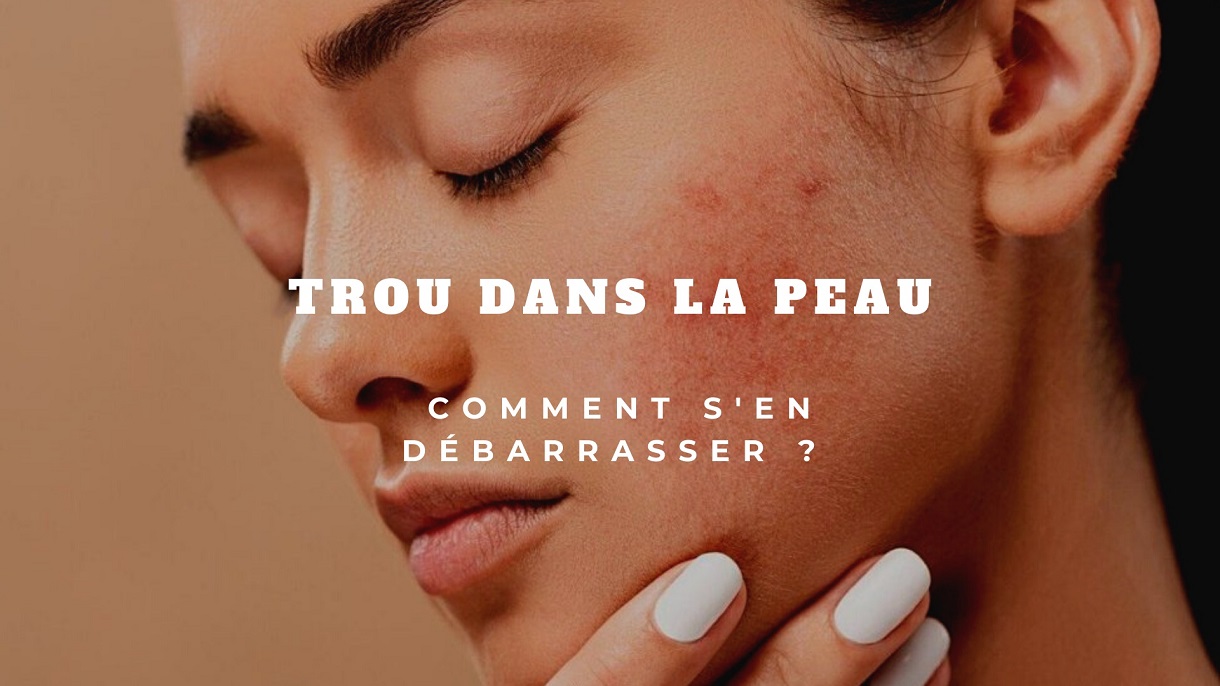 trou dans la peau
